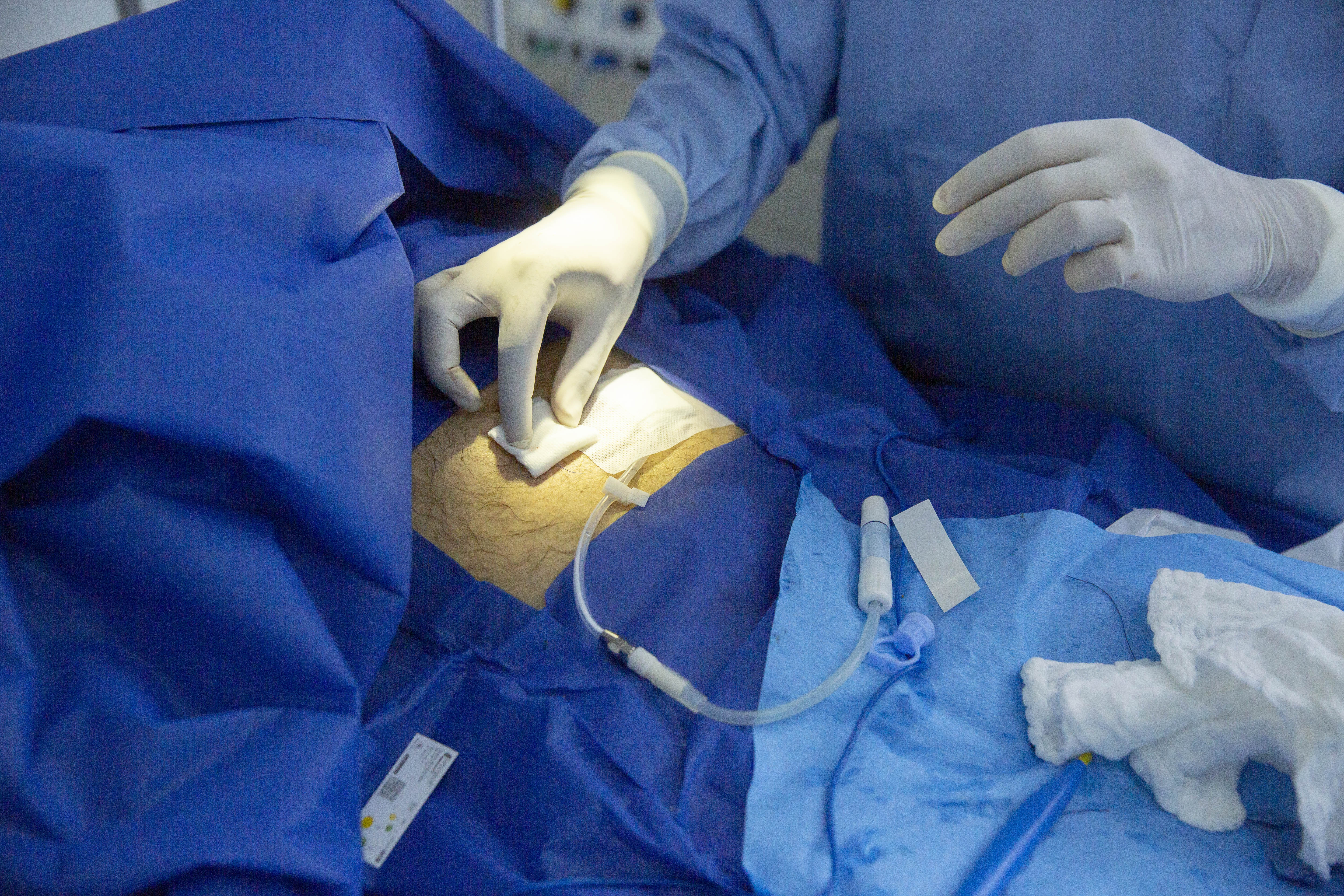Perioperative and Intraoperative Management